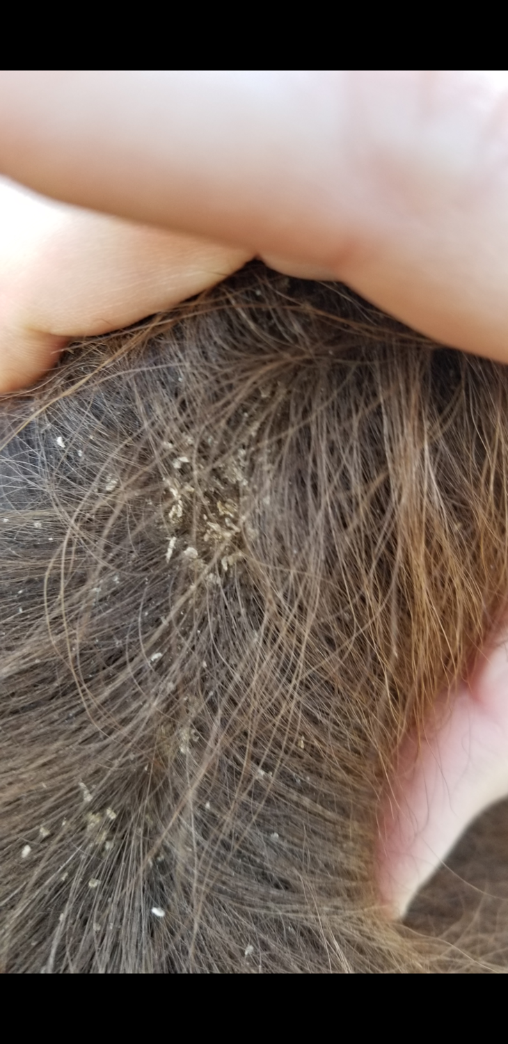 Lice BackYardHerds Goats, Horses, Sheep, Pigs & more